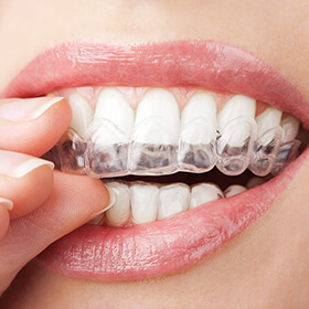 LA Dental Arts - Bershadsky DDS - Los Angeles Dentist - Branded Dental Products Photo LA Dental Arts - Bershadsky DDS - Los Angeles Dentist - Branded Dental Products Photo