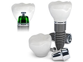 dental-implant-surgery