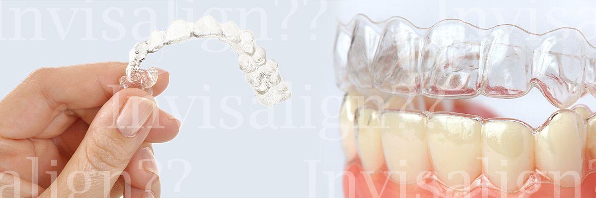 LA Dental Arts-Bershadsky DDS-Los Angeles Dentist-does invisalign work LA Dental Arts-Bershadsky DDS-Los Angeles Dentist-does invisalign work