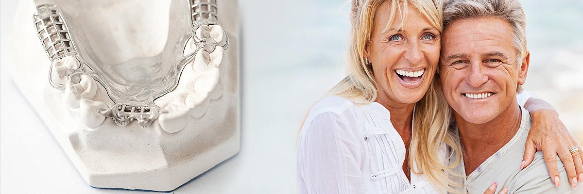 implant-supported-dentures-header