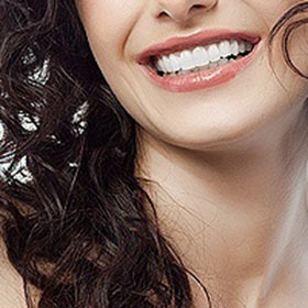 smile-makeover