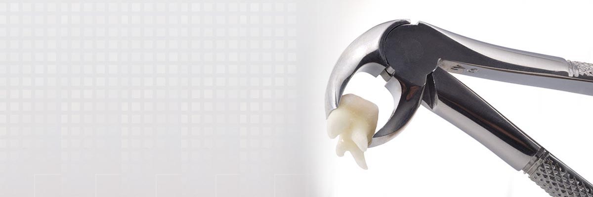 tooth-extraction-header